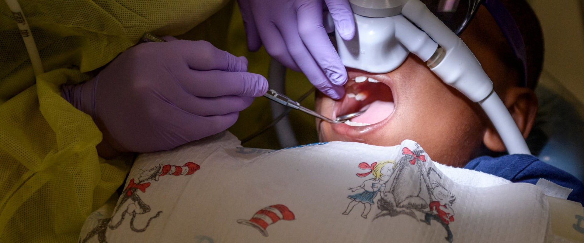 Special Considerations for Children Undergoing Dental Surgery
