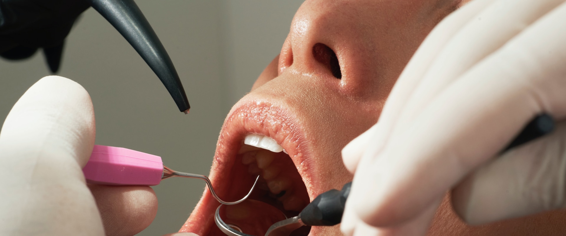 What is the Role of Dental Surgery in Oral Health?