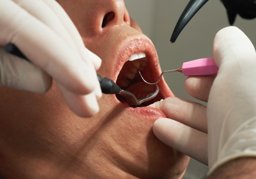Everything You Need to Know About Dental Procedures and Surgery