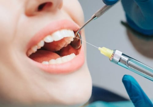 What Type of Anesthesia is Used for Dental Surgery?
