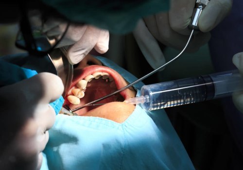 What is the Purpose of Dental Surgery?