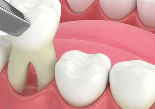 Medication After Dental Surgery: What You Need to Know